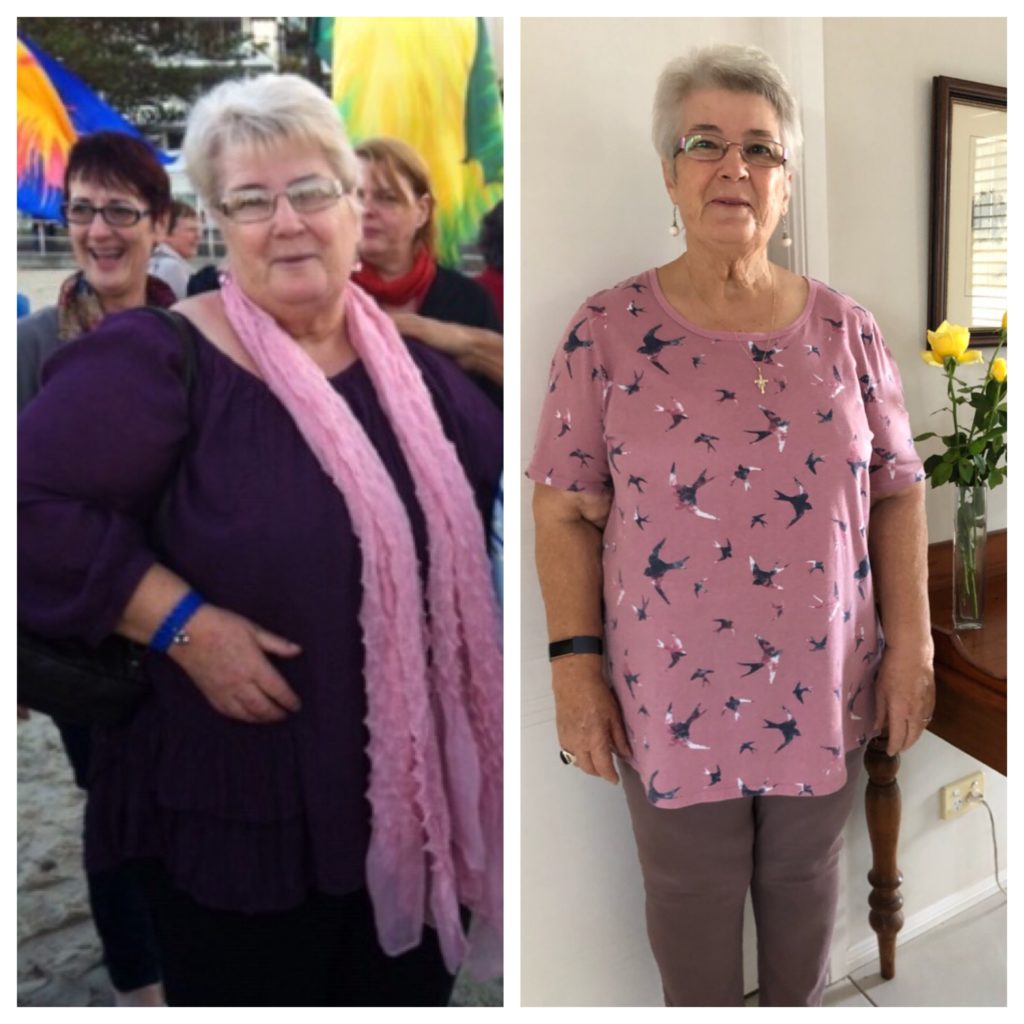 Gayle's Before & After Featured on Diet Doctor July 1, 2019